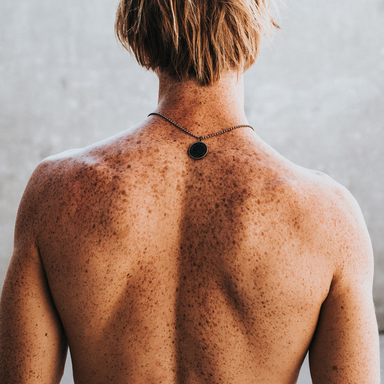 Man's back with freckles 